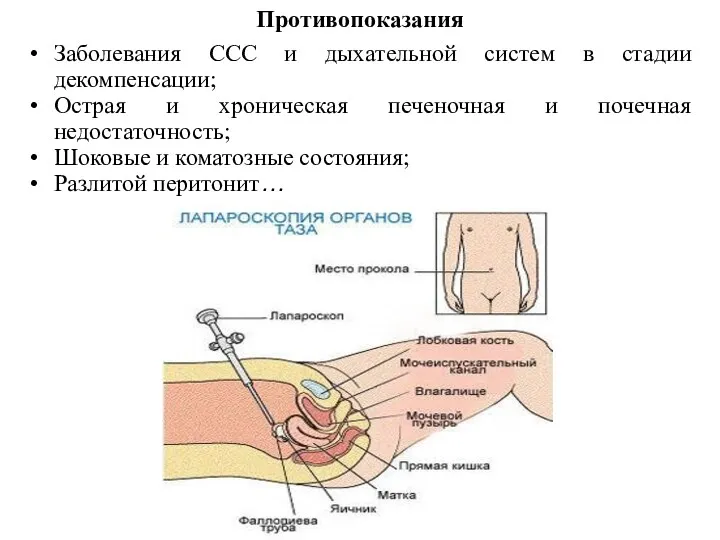 Противопоказания Заболевания ССС и дыхательной систем в стадии декомпенсации; Острая