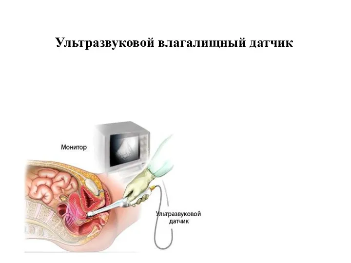 Ультразвуковой влагалищный датчик