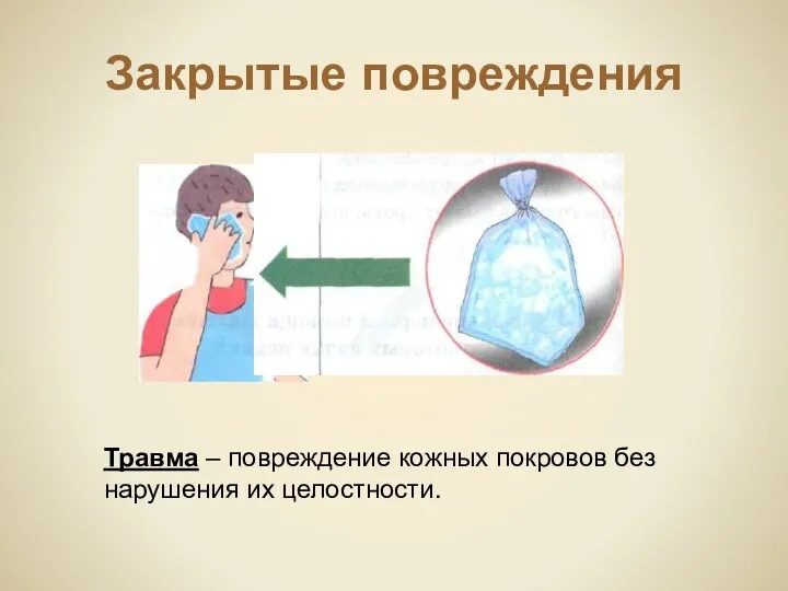 Закрытые повреждения Травма – повреждение кожных покровов без нарушения их целостности.