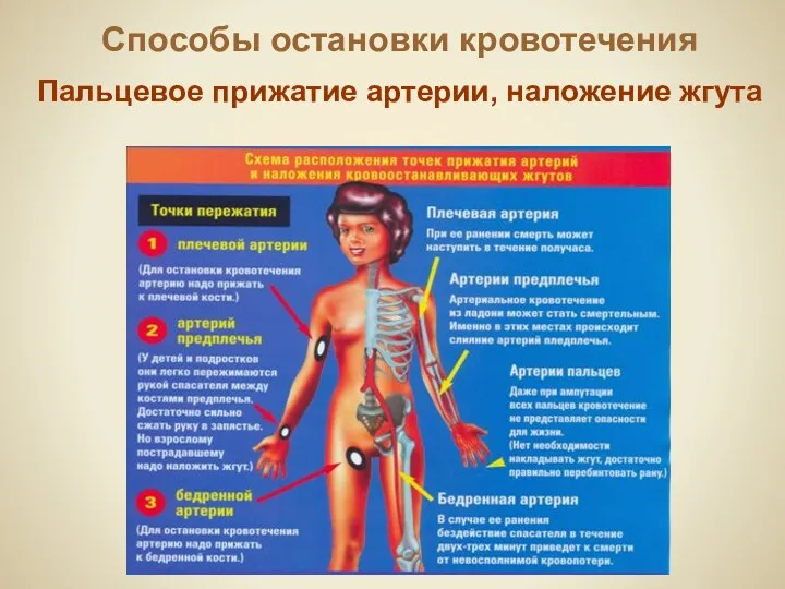 Способы остановки кровотечения Пальцевое прижатие артерии, наложение жгута