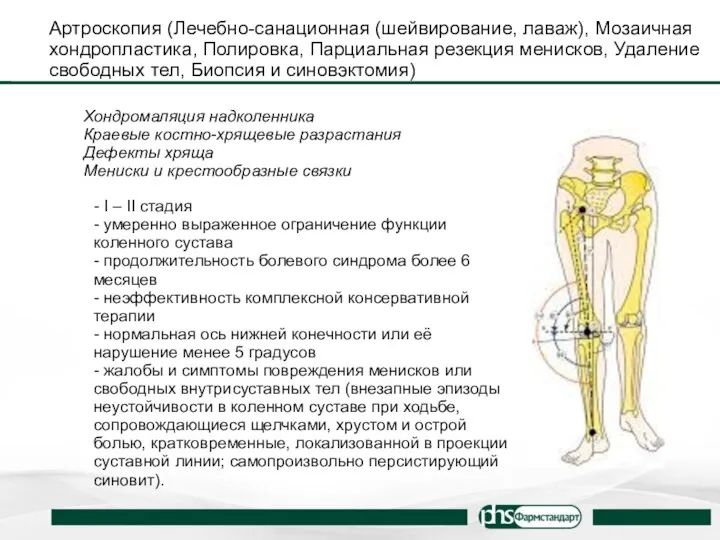 Артроскопия (Лечебно-санационная (шейвирование, лаваж), Мозаичная хондропластика, Полировка, Парциальная резекция менисков,