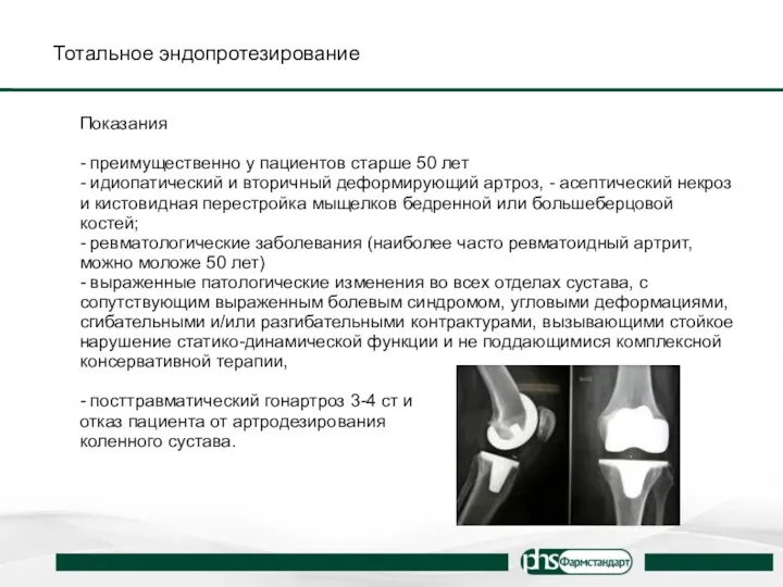 Тотальное эндопротезирование Показания - преимущественно у пациентов старше 50 лет