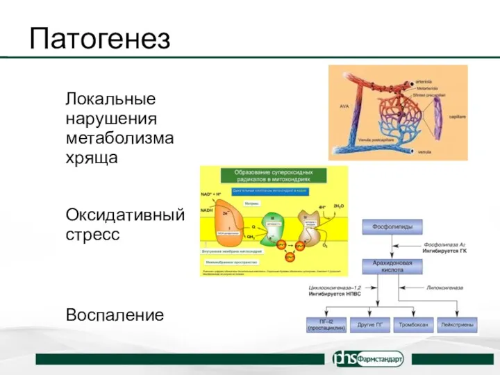 Патогенез Локальные нарушения метаболизма хряща Оксидативный стресс Воспаление