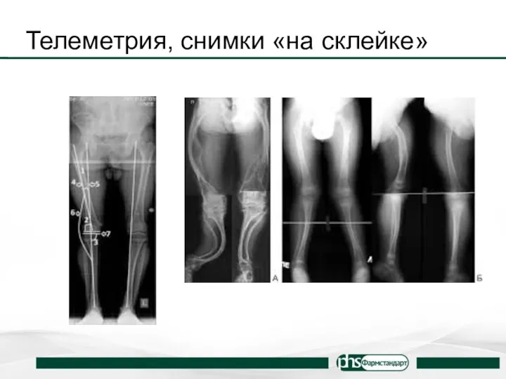 Телеметрия, снимки «на склейке»