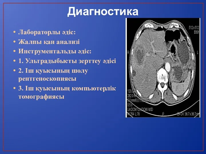 Диагностика Лабораторлы әдіс: Жалпы қан анализі Инструментальды әдіс: 1. Ультрадыбысты зерттеу әдісі 2.