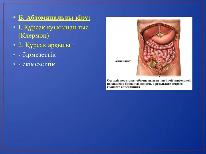 Б. Абдоминальды кіру: I. Құрсақ қуысынан тыс (Клермон) 2. Құрсақ арқылы : - бірмезеттік - екімезеттік