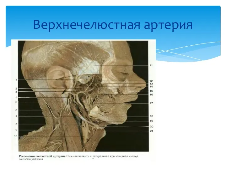 Верхнечелюстная артерия