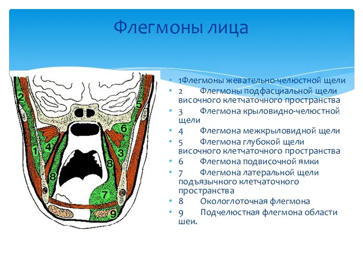 Флегмоны лица 1 Флегмоны жевательно-челюстной щели 2 Флегмоны подфасциальной щели