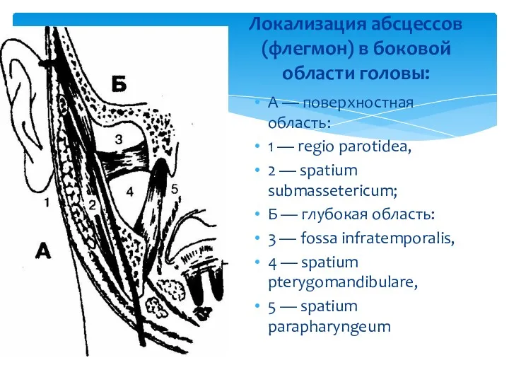 Локализация абсцессов (флегмон) в боковой области головы: А — поверхностная