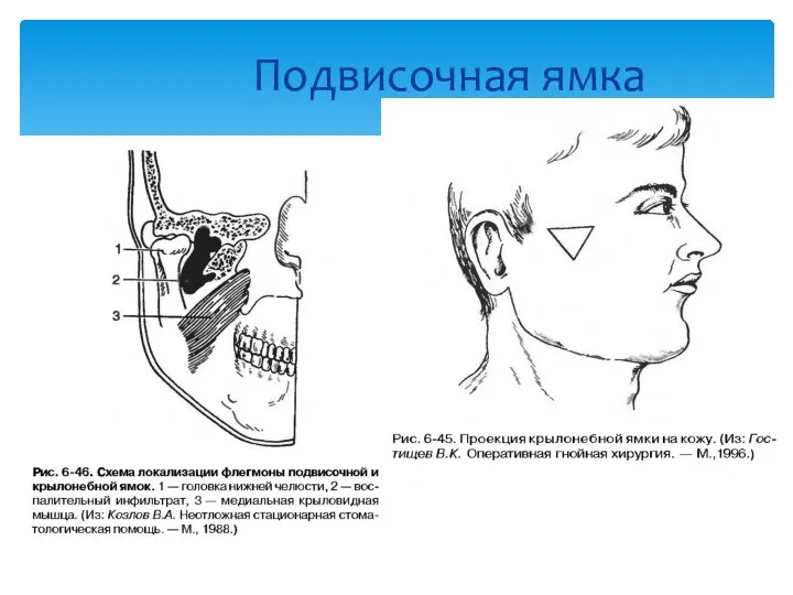 Подвисочная ямка