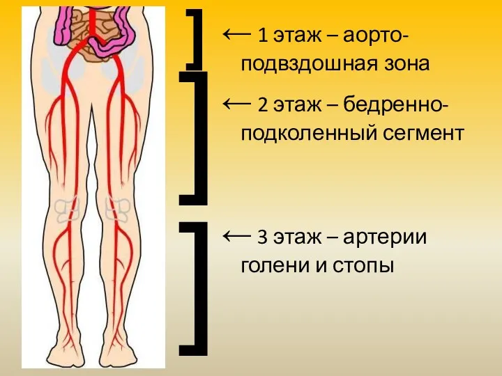 ← 1 этаж – аорто-подвздошная зона ← 2 этаж –