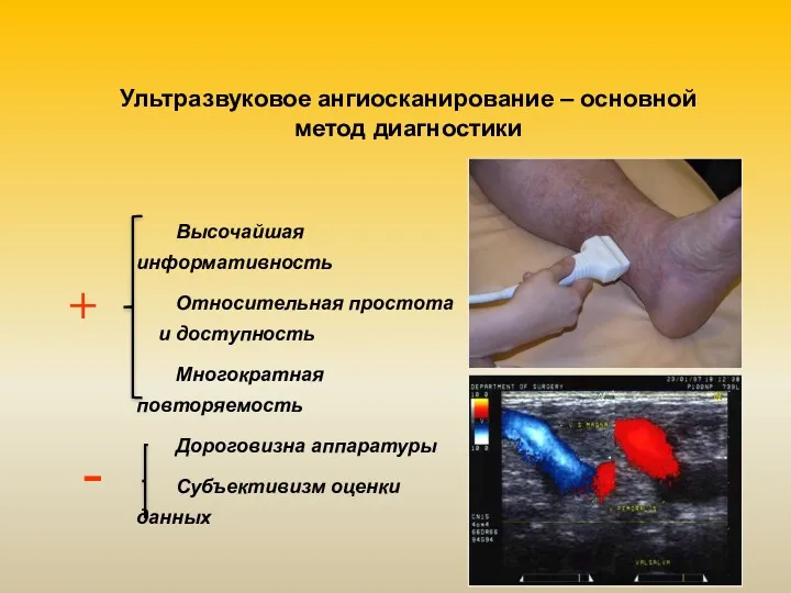 Ультразвуковое ангиосканирование – основной метод диагностики + - Высочайшая информативность