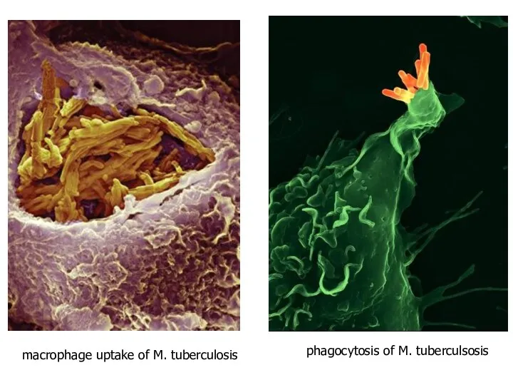 macrophage uptake of M. tuberculosis phagocytosis of M. tuberculsosis