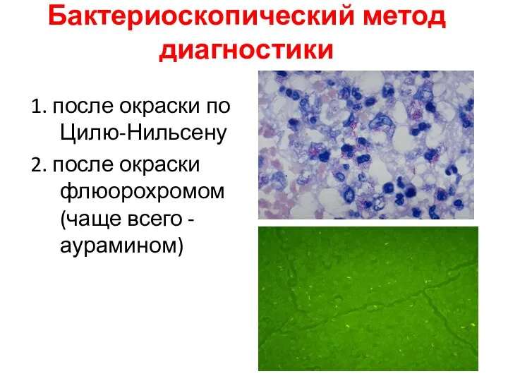 Бактериоскопический метод диагностики 1. после окраски по Цилю-Нильсену 2. после окраски флюорохромом (чаще всего - аурамином)