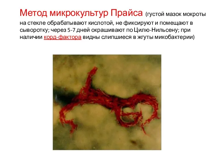 Метод микрокультур Прайса (густой мазок мокроты на стекле обрабатывают кислотой,