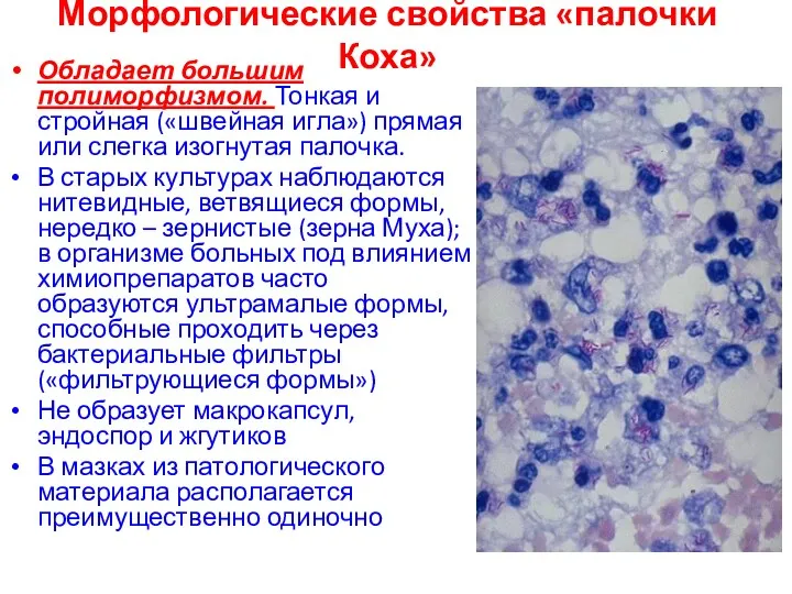 Морфологические свойства «палочки Коха» Обладает большим полиморфизмом. Тонкая и стройная