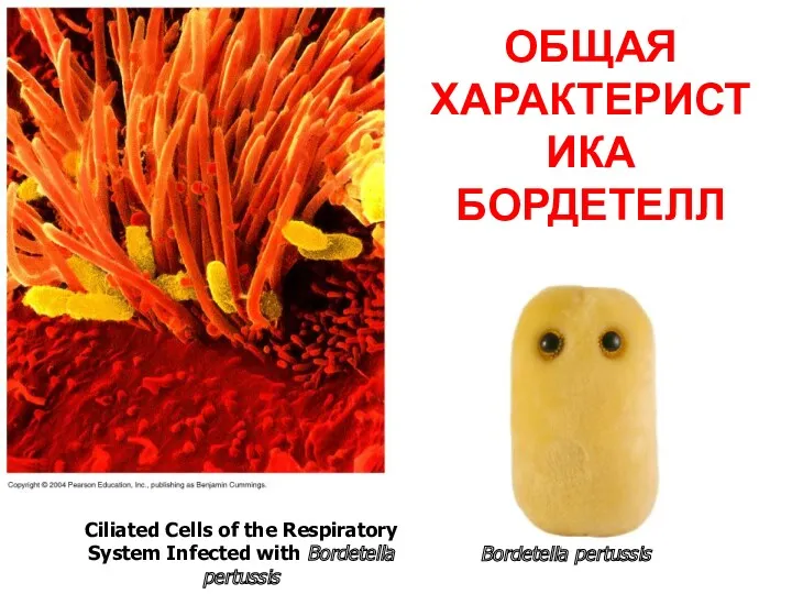 Ciliated Cells of the Respiratory System Infected with Bordetella pertussis Bordetella pertussis ОБЩАЯ ХАРАКТЕРИСТИКА БОРДЕТЕЛЛ