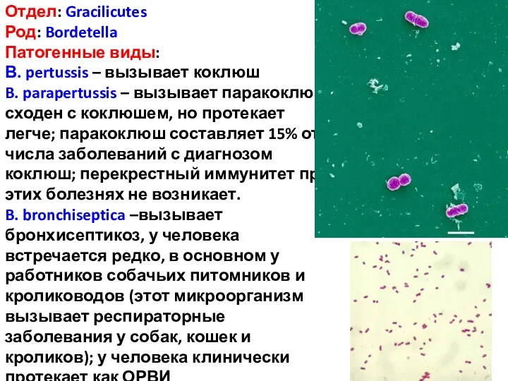 Отдел: Gracilicutes Род: Bordetella Патогенные виды: В. pertussis – вызывает