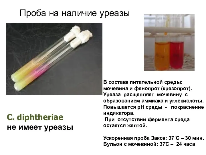 Проба на наличие уреазы C. diphtheriae не имеет уреазы В