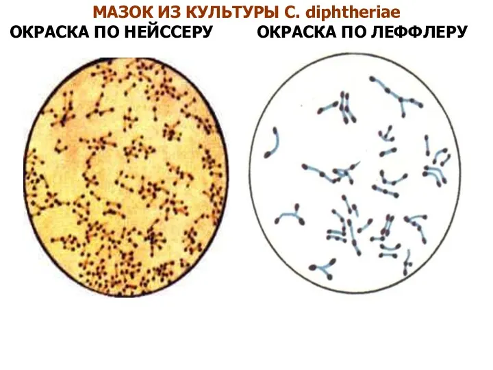 МАЗОК ИЗ КУЛЬТУРЫ C. diphtheriae ОКРАСКА ПО НЕЙССЕРУ ОКРАСКА ПО ЛЕФФЛЕРУ