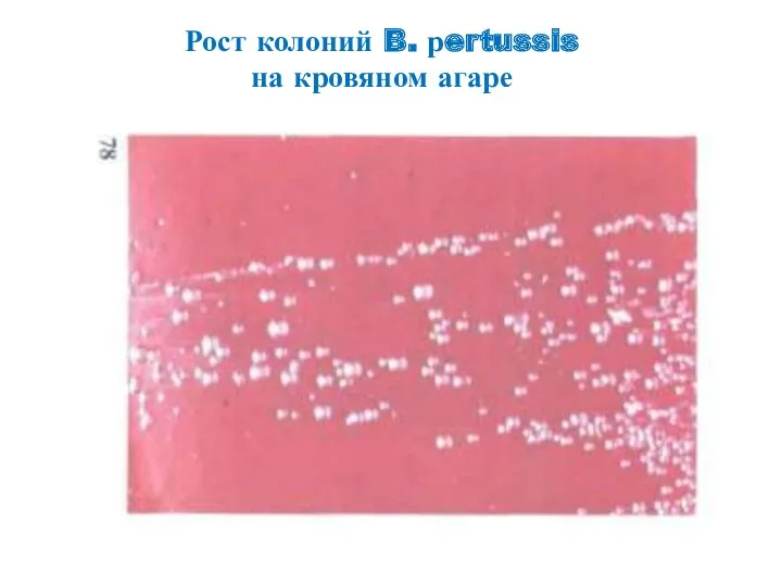 Рост колоний B. рertussis на кровяном агаре
