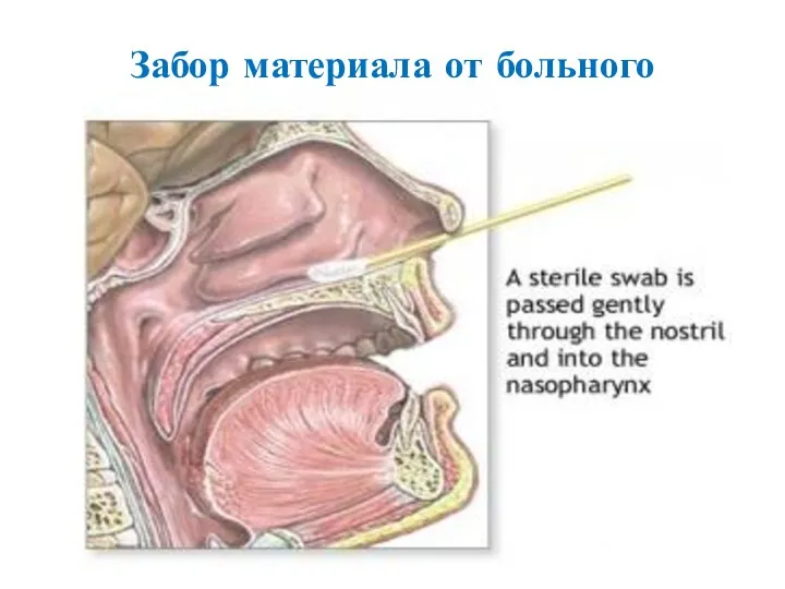 Забор материала от больного