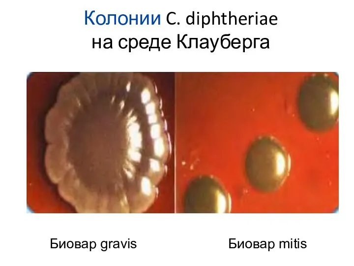 Колонии C. diphtheriae на среде Клауберга Биовар gravis Биовар mitis