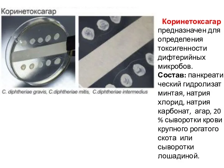 Коринетоксагар предназначен для определения токсигенности дифтерийных микробов. Состав: панкреатический гидролизат