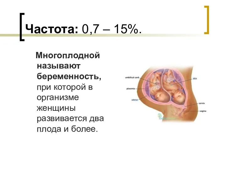 Частота: 0,7 – 15%. Многоплодной называют беременность, при которой в