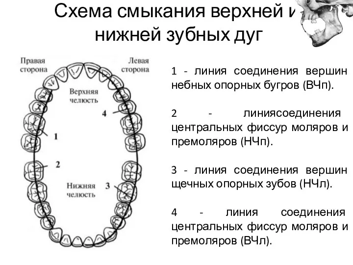 Схема смыкания верхней и нижней зубных дуг 1 - линия