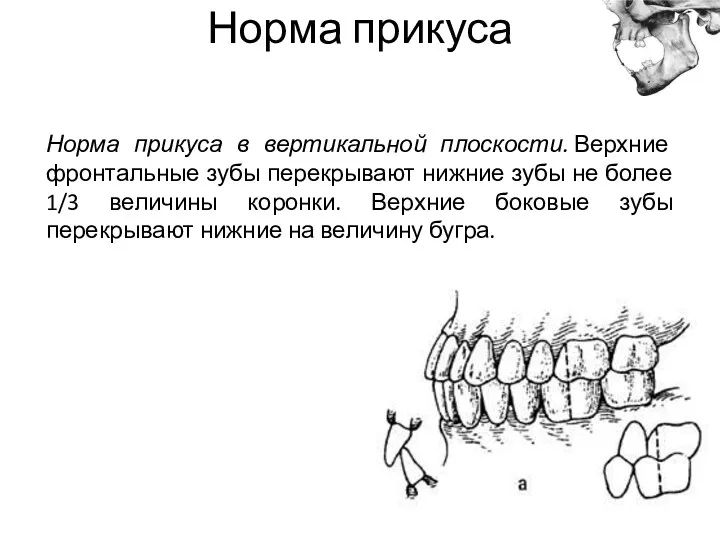 Норма прикуса Норма прикуса в вертикальной плоскости. Верхние фронтальные зубы