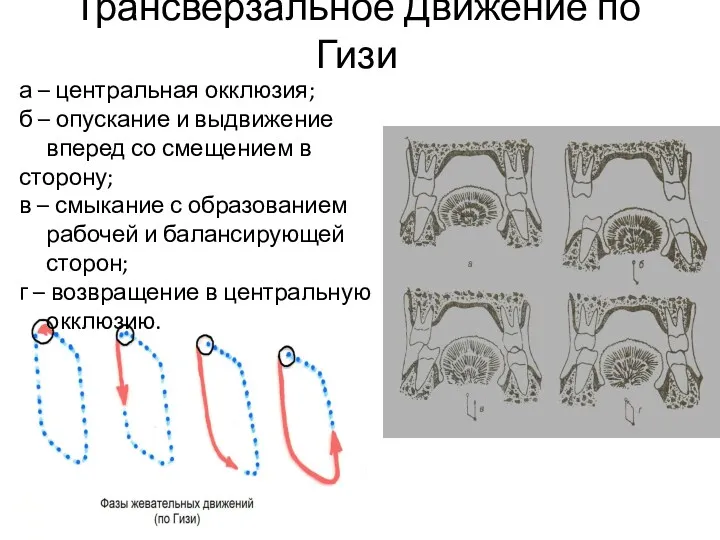 Трансверзальное Движение по Гизи а – центральная окклюзия; б –