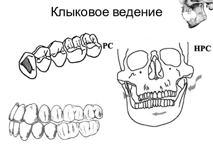 Клыковое ведение