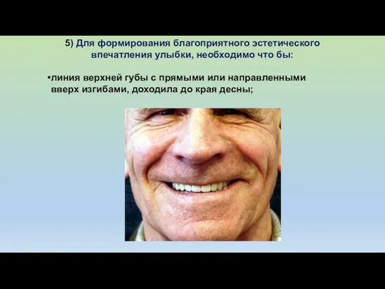 5) Для формирования благоприятного эстетического впечатления улыбки, необходимо что бы: