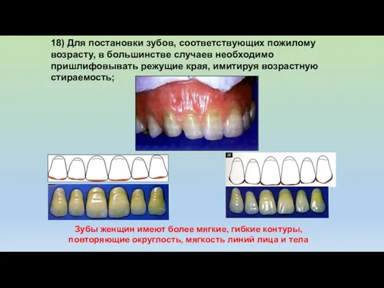 18) Для постановки зубов, соответствующих пожилому возрасту, в большинстве случаев
