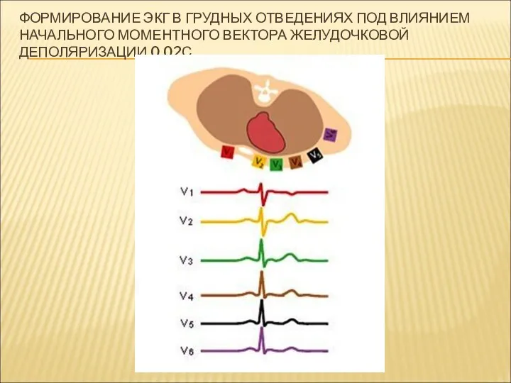 ФОРМИРОВАНИЕ ЭКГ В ГРУДНЫХ ОТВЕДЕНИЯХ ПОД ВЛИЯНИЕМ НАЧАЛЬНОГО МОМЕНТНОГО ВЕКТОРА ЖЕЛУДОЧКОВОЙ ДЕПОЛЯРИЗАЦИИ 0,02С.