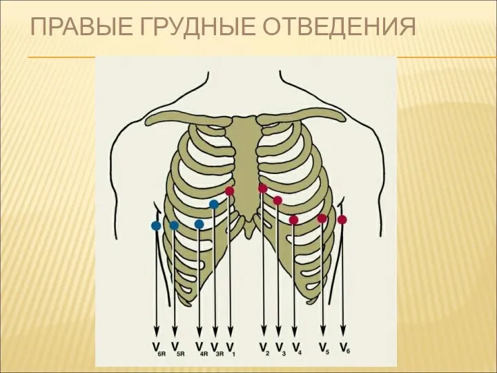 ПРАВЫЕ ГРУДНЫЕ ОТВЕДЕНИЯ