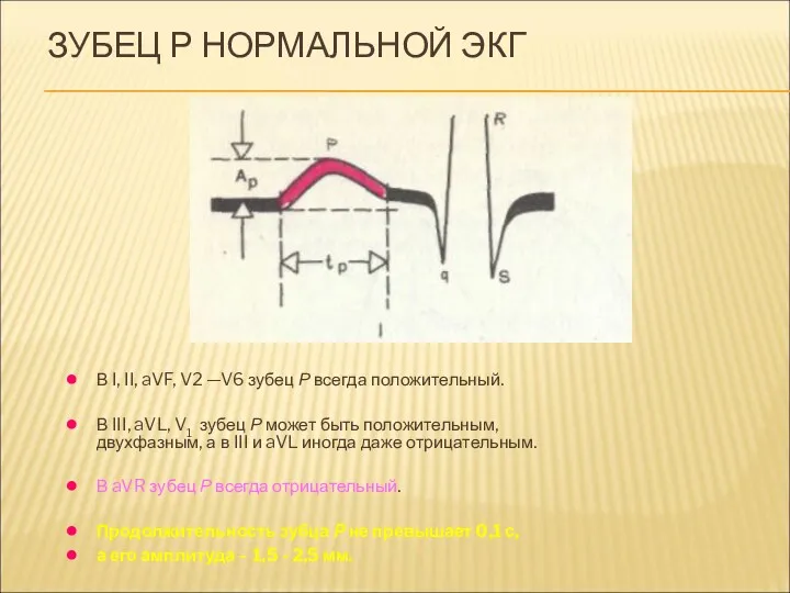 ЗУБЕЦ Р НОРМАЛЬНОЙ ЭКГ В I, II, aVF, V2 —V6