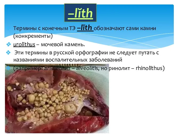 Термины с конечным ТЭ –lĭth обозначают сами камни (конкременты) urolĭthus