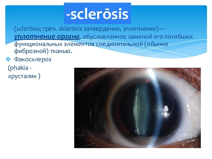 (sclerōsis; греч. sklerōsis затвердение, уплотнение)— уплотнение органа, обусловленное заменой его