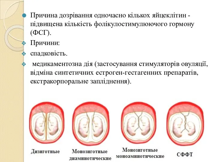 Причина дозрівання одночасно кількох яйцеклітин - підвищена кількість фолікулостимулюючого гормону