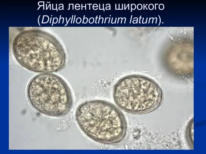 Яйца лентеца широкого (Diphyllobothrium latum).