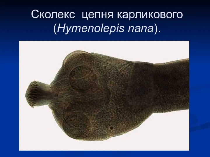Сколекс цепня карликового (Hymenolepis nana).