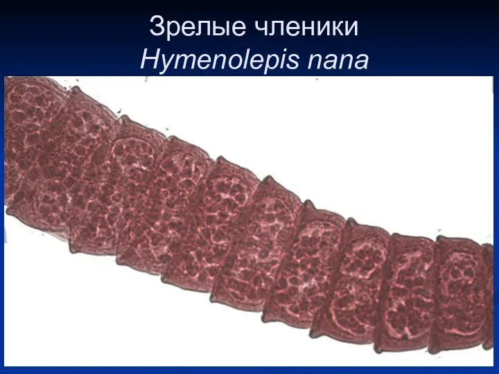 Зрелые членики Hymenolepis nana