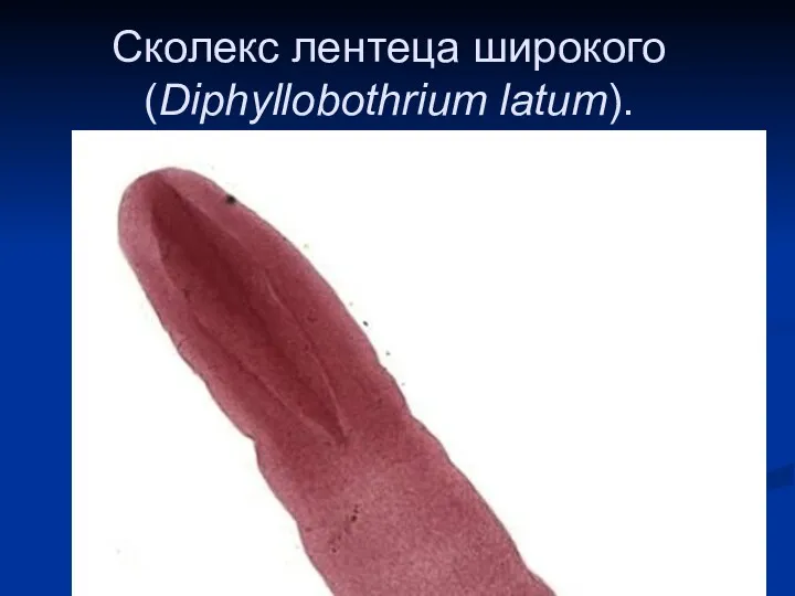 Сколекс лентеца широкого (Diphyllobothrium latum).