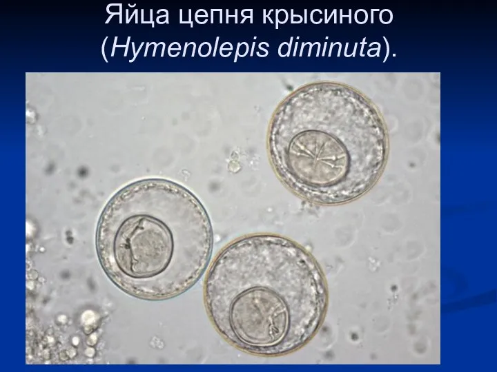 Яйца цепня крысиного (Hymenolepis diminuta).