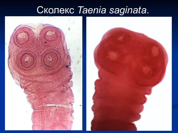 Сколекс Taenia saginata.