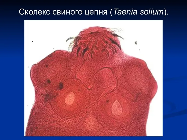 Сколекс свиного цепня (Taenia solium).