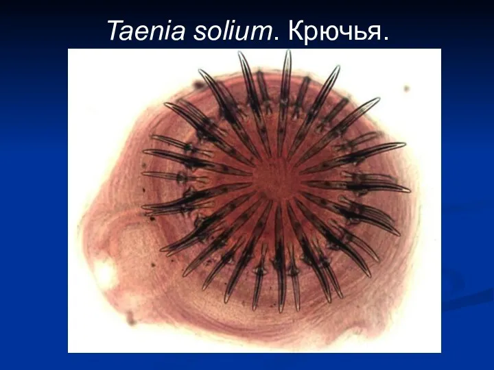 Taenia solium. Крючья.