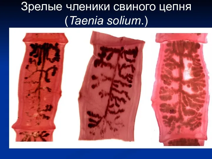 Зрелые членики свиного цепня (Taenia solium.)